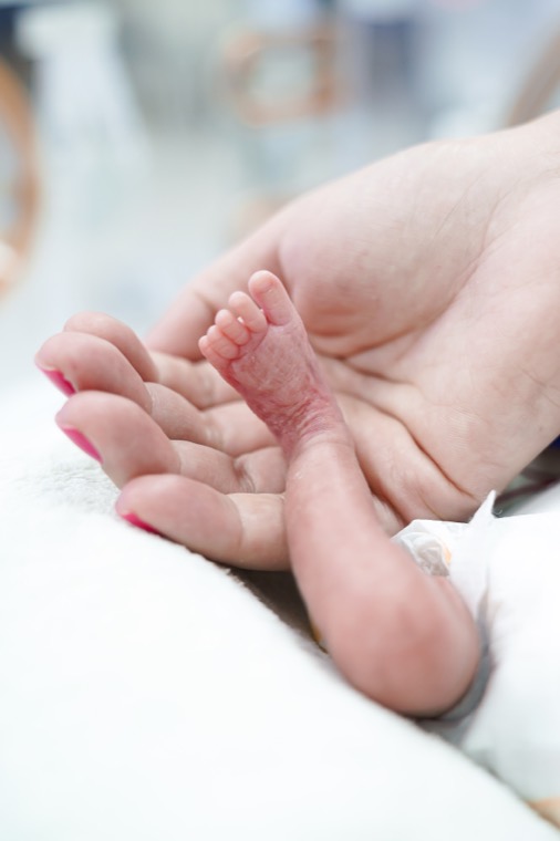Unidade Neonatal